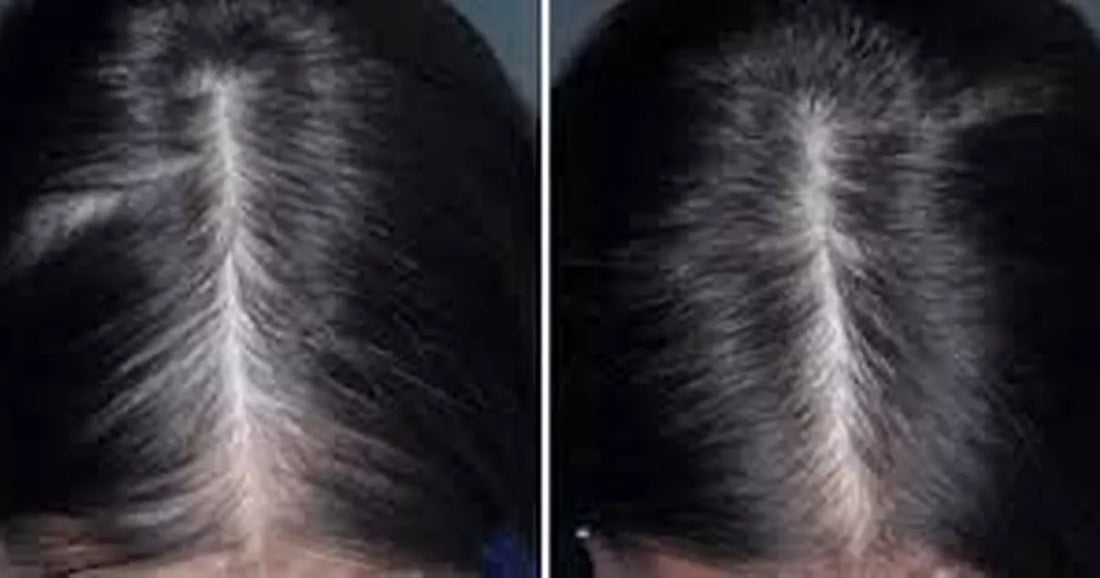 A thickening hair foam product image used in a UK retail news story