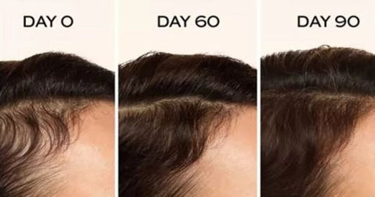 Hair serum bottle photographed for a retail beauty feature