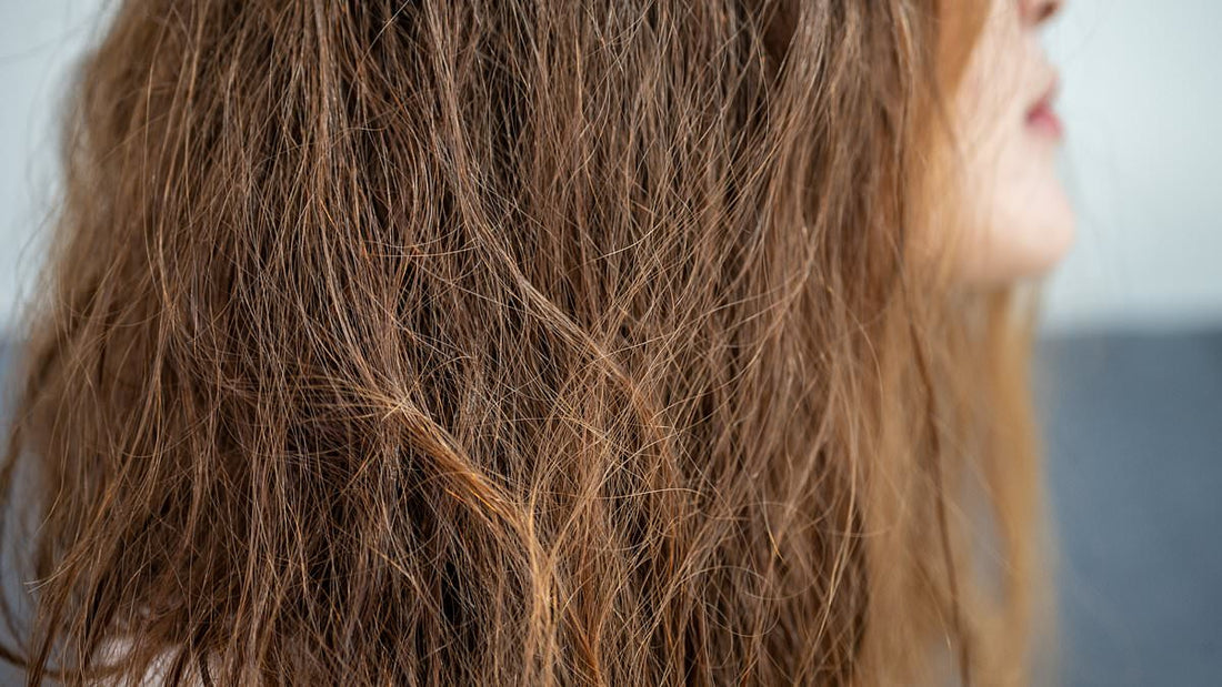Woman with dry, flyaway winter hair indoors near a radiator