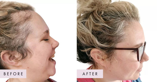 Hair supplement capsules pictured in a UK publisher thumbnail-style product image