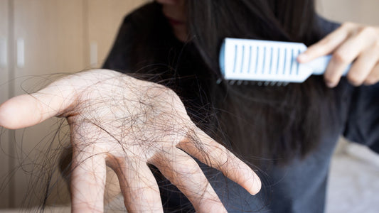 Close-up of patchy hair loss on scalp, illustrating alopecia areata potentially linked to stress