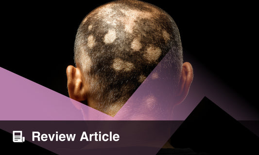 Illustration of hair and scalp representing alopecia areata discussion