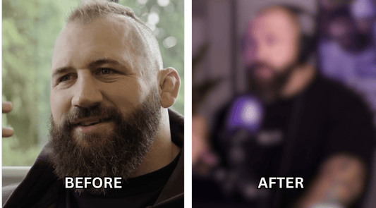 Joe Marler reveals new hair transplant after Celebrity Traitors
