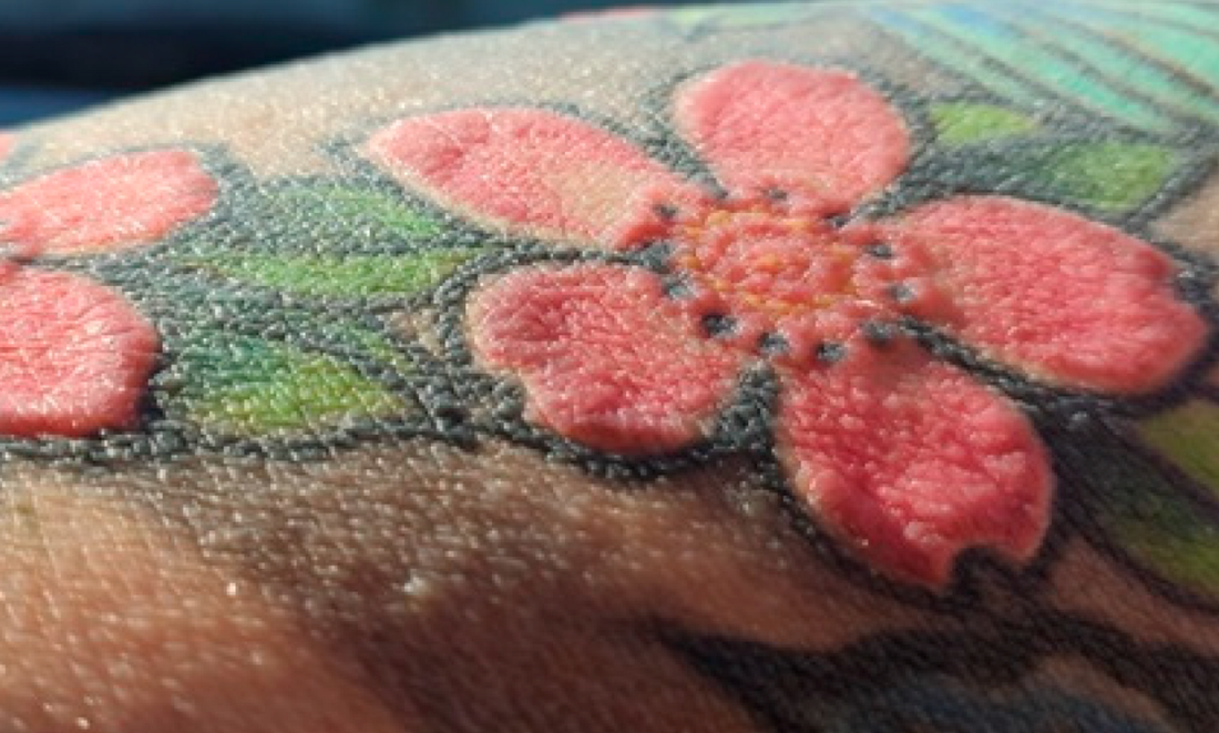 Close-up of skin changes within red tattoo ink on a forearm