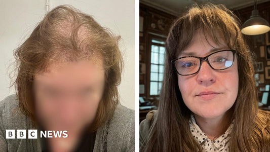 Jo on stage, a Stoke-on-Trent stand-up comedian who has lived with hair-pulling disorder since age 11