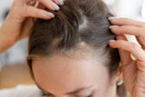 Close-up of a bald scalp, illustrating hair loss and wig-related legal news