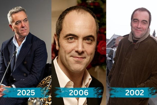 James Nesbitt pictured in a Belfast Telegraph video thumbnail about his hair transplant